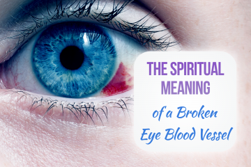 broken-blood-vessel-eye-spiritualism